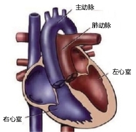 [健康]新生儿心脏主动脉和肺动脉长反了 4小时